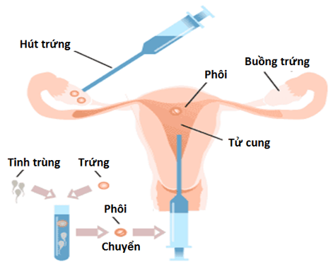 Lý thuyết Sinh học 11 Bài 47: Điều khiển sinh sản ở động vật và sinh đẻ có kế hoạch ở người | Lý thuyết Sinh học 11 ngắn gọn