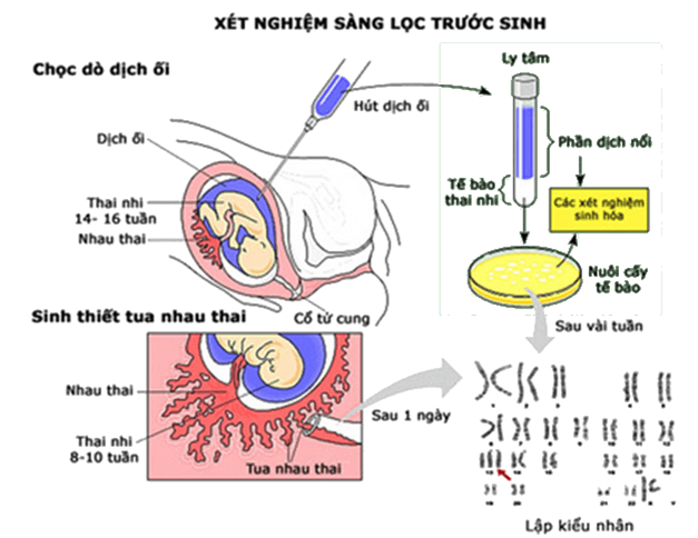 Bài 22: Bảo vệ vốn gen của loài người và một số vấn đề xã hội của di truyền học