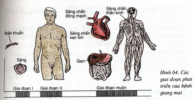 Lý thuyết Sinh học 8  Bài 64: Các bệnh lây truyền qua đường sinh dục hay, ngắn gọn