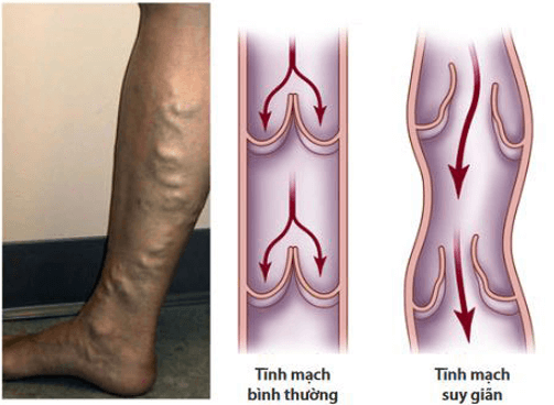 Giáo án Sinh học 11 Chân trời sáng tạo Bài 10: Tuần hoàn ở động vật