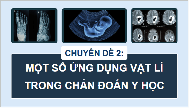 Giáo án điện tử Chuyên đề Vật Lí 12 Kết nối tri thức Bài 5: Tia X | PPT Chuyên đề Vật Lí 12