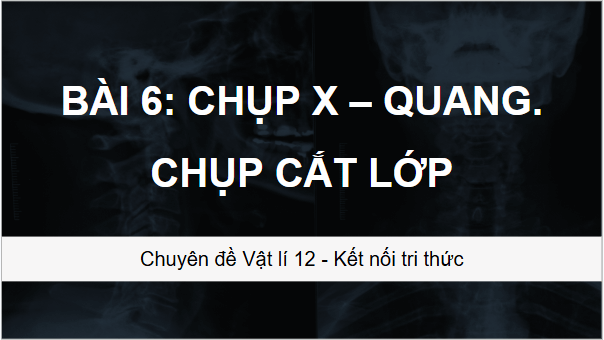 Giáo án điện tử Chuyên đề Vật Lí 12 Kết nối tri thức Bài 6: Chụp X-quang. Chụp cắt lớp | PPT Chuyên đề Vật Lí 12