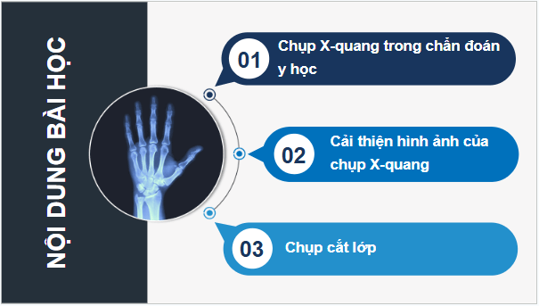 Giáo án điện tử Chuyên đề Vật Lí 12 Kết nối tri thức Bài 6: Chụp X-quang. Chụp cắt lớp | PPT Chuyên đề Vật Lí 12