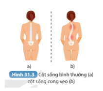 Giáo án Sinh học 8 Kết nối tri thức (năm 2024 mới nhất) | Giáo án Khoa học tự nhiên 8