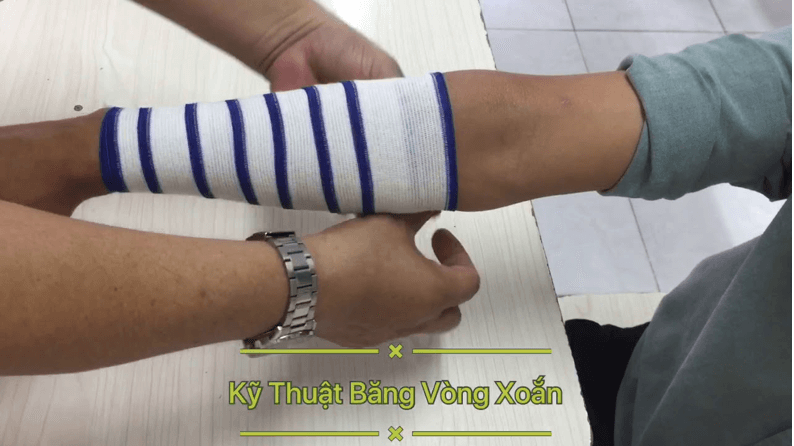 Lý thuyết GDQP 10 Cánh diều Bài 2: Kĩ thuật cấp cứu và chuyển thương (ảnh 8)