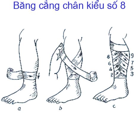 Lý thuyết GDQP 10 Kết nối tri thức Bài 12: Kĩ thuật cấp cứu và chuyển thương