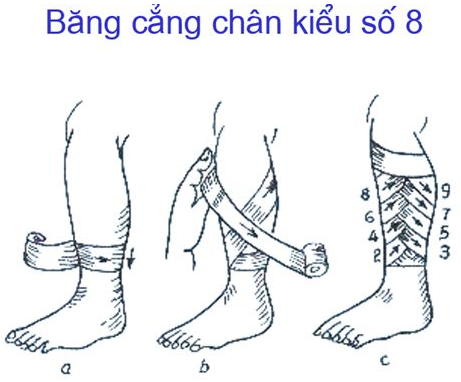 Nêu các loại băng và kĩ thuật các kiểu băng cơ bản