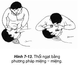 Phương pháp thổi ngạt và ép tim ngoài lồng ngực