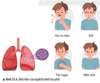 Lý thuyết Khoa học tự nhiên 6 Bài 25: Vi khuẩn