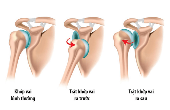 Lý thuyết KHTN 8 Cánh diều Bài 28: Hệ vận động ở người