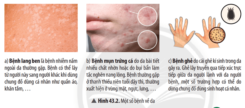 Quan sát Hình 43.2, hãy hoàn thành bảng sau