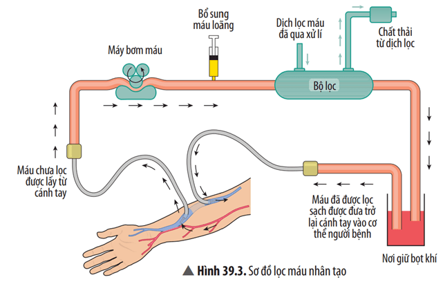 Quan sát Hình 39.3 và mô tả khái quát sơ đồ chạy thận nhân tạo