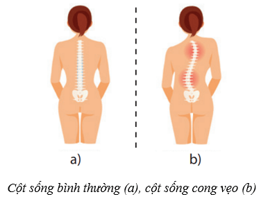 Lý thuyết KHTN 8 Kết nối tri thức Bài 31: Hệ vận động ở người 