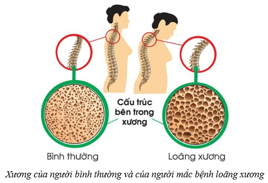 Lý thuyết KHTN 8 Kết nối tri thức Bài 31: Hệ vận động ở người 