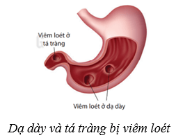 Lý thuyết KHTN 8 Kết nối tri thức Bài 32: Dinh dưỡng và tiêu hóa ở người 