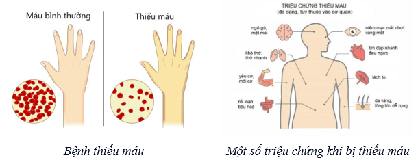 Lý thuyết KHTN 8 Kết nối tri thức Bài 33: Máu và hệ tuần hoàn của cơ thể người 