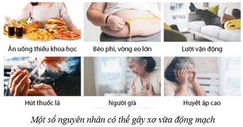 Lý thuyết KHTN 8 Kết nối tri thức Bài 33: Máu và hệ tuần hoàn của cơ thể người 