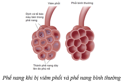 Lý thuyết KHTN 8 Kết nối tri thức Bài 34: Hệ hô hấp ở người 