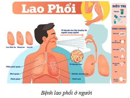 Lý thuyết KHTN 8 Kết nối tri thức Bài 34: Hệ hô hấp ở người 