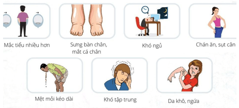 Lý thuyết KHTN 8 Kết nối tri thức Bài 35: Hệ bài tiết ở người 