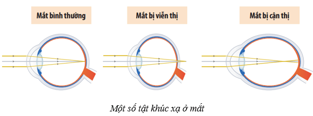 Lý thuyết KHTN 8 Kết nối tri thức Bài 37: Hệ thần kinh và các giác quan ở người 