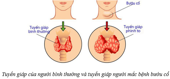 Lý thuyết KHTN 8 Kết nối tri thức Bài 38: Hệ nội tiết ở người 