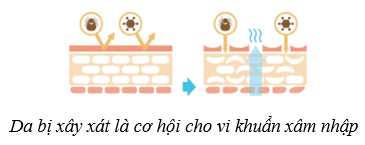 Lý thuyết KHTN 8 Kết nối tri thức Bài 39: Da và điều hòa thân nhiệt ở người 