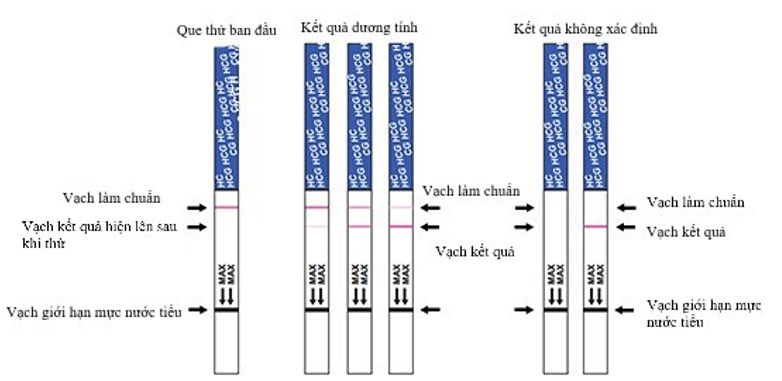 Que thử thai Cách sử dụng và đọc vạch chính xác nhất