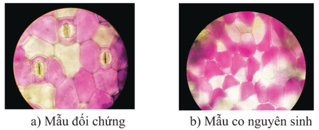 Mô tả hình dạng và vẽ các tế bào biểu bì và các tế bào cấu tạo nên khí khổng ở mẫu đối chứng