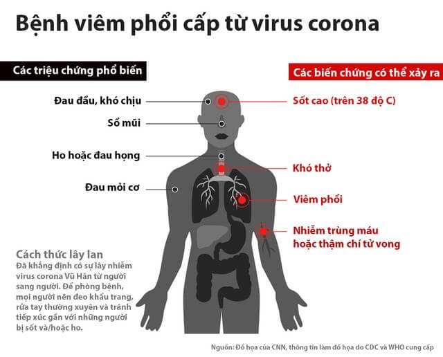 Lý thuyết Sinh 10 Chân trời sáng tạo Bài 29: Virus