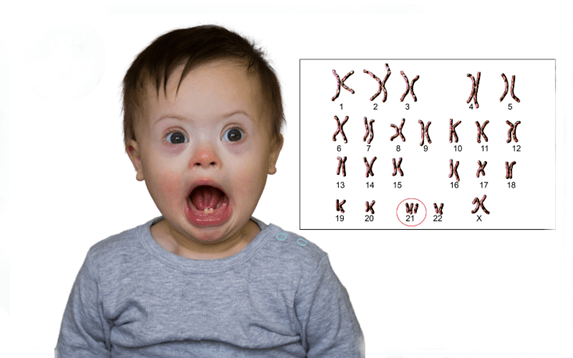 Lý thuyết Di truyền học người (Sinh 12 Cánh diều Bài 14)