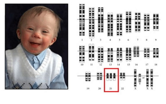 Lý thuyết Đột biến nhiễm sắc thể (Sinh 12 Cánh diều Bài 6)