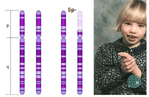 Lý thuyết Đột biến nhiễm sắc thể (Sinh 12 Kết nối tri thức Bài 12)