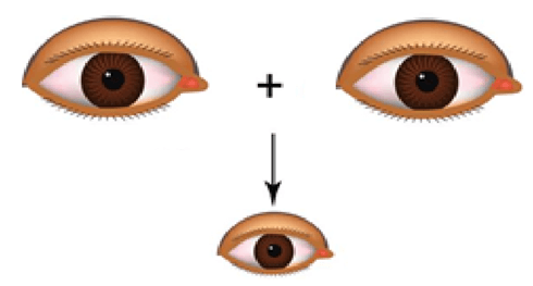 Lý thuyết Đột biến nhiễm sắc thể (Sinh 12 Kết nối tri thức Bài 12)