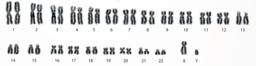 Lý thuyết Di truyền học người và di truyền y học (Sinh 12 Kết nối tri thức Bài 13)