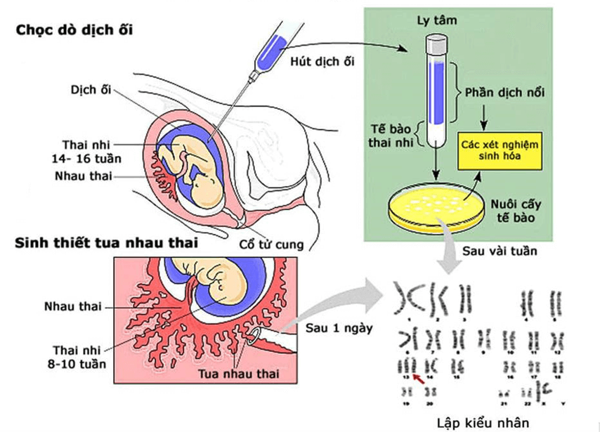 Lý thuyết Di truyền học người và di truyền y học (Sinh 12 Kết nối tri thức Bài 13)