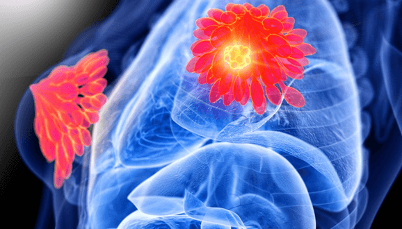 Lý thuyết Gene, quá trình truyền đạt thông tin di truyền và hệ gene (Sinh 12 Kết nối tri thức Bài 2)