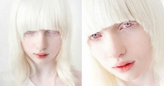 Lý thuyết Đột biến gene (Sinh 12 Kết nối tri thức Bài 4)