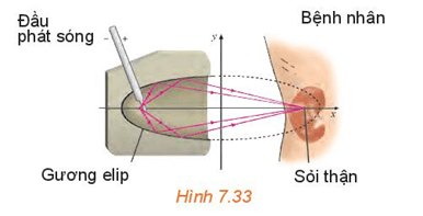 Gương elip trong một máy tán sỏi thận (H.7.33) ứng với elip có phương trình