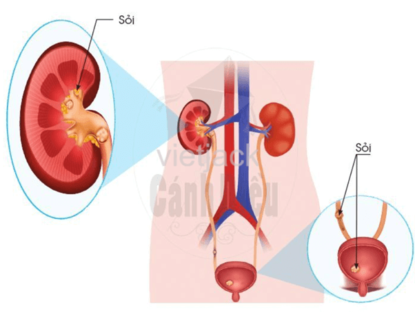 Bài 18: Cơ quan bài tiét nước tiểu phòng tránh bệnh sỏi thận hay nhất