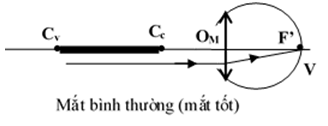 100 câu trắc nghiệm Mắt, Các dụng cụ quang có lời giải (cơ bản - phần 1)