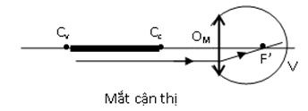 100 câu trắc nghiệm Mắt, Các dụng cụ quang có lời giải (cơ bản - phần 1)