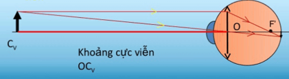 Các dạng bài tập về mắt và cách giải hay, chi tiết