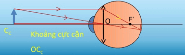 Các dạng bài tập về mắt và cách giải hay, chi tiết