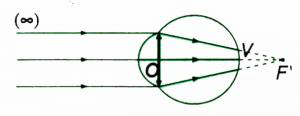 Các dạng bài tập về mắt và cách giải hay, chi tiết