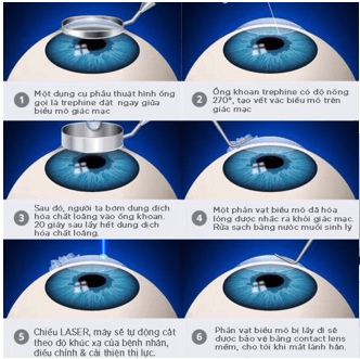 Lý thuyết Mắt | Chuyên đề: Lý thuyết - Bài tập Vật Lý 11 có đáp án