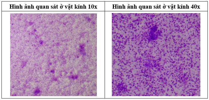 Vẽ vào ô trống dưới đây hình ảnh sữa chua đã quan sát